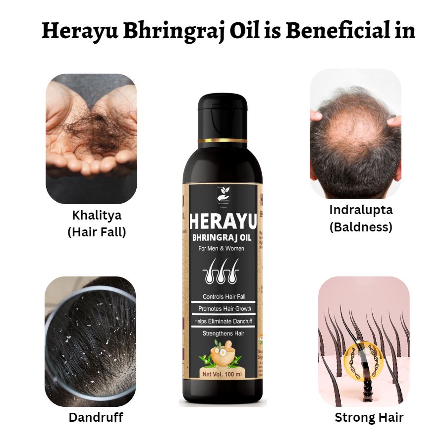 Songara Herayu Bhringraj Oil Classic (100 ml) for Hair Fall and Hair Growth - Oil
